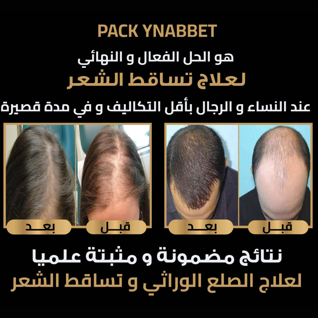 YNABET extra the best seller 100ml