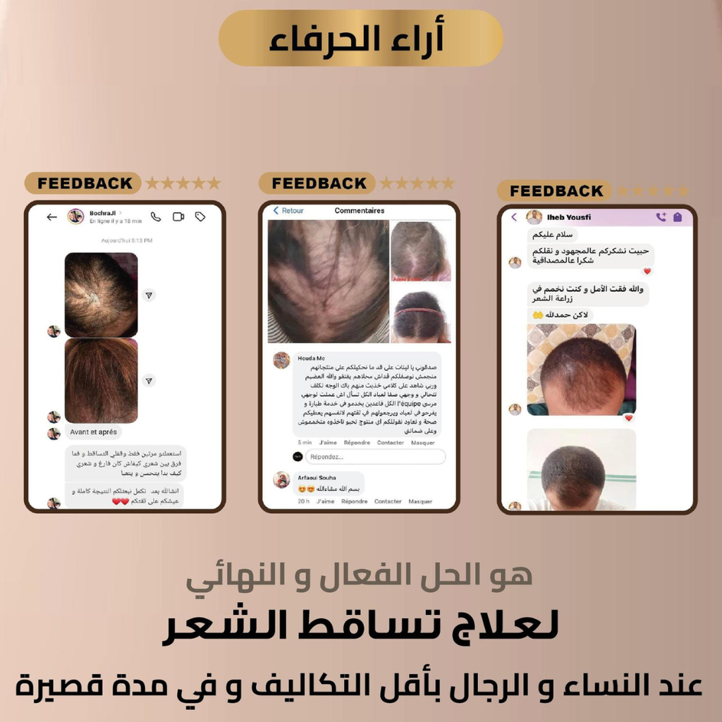 YNABET extra the best seller 100ml