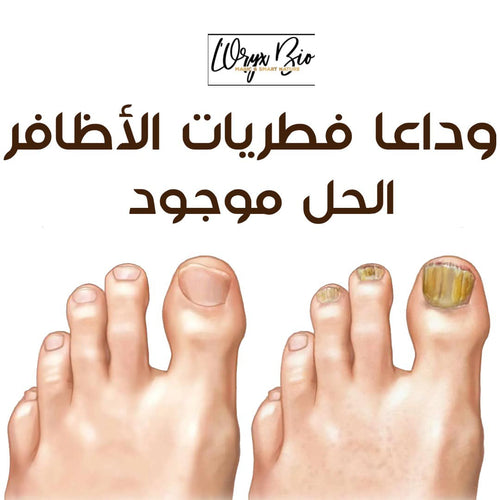 Le Sérum Mycostop est un concentré de 12 plantes puissantes antifongiques, nourrissantes, réparatrices et revitalisantes. Cette formulation unique assure un traitement efficace et rapide pour les mycoses de l’ongle et permet de reconstruire un ongle sain. Ce traitement local permet de soigner efficacement et durablement les mycoses de l’ongle (onychomycose) et évite la propagation de l’infection fongique (les dermatophytes) sur les autres ongles du pied. Elle renforce la fonction barrière de l’ongle et rest